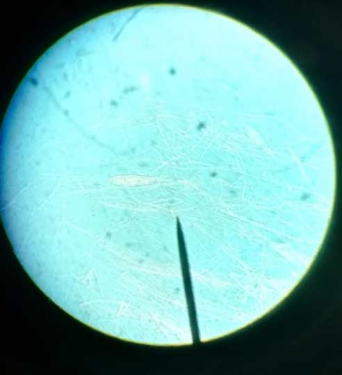 Vetrino di Microsporum canis al microscopio.